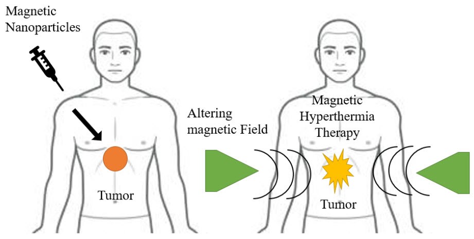 Figure 5 Cancer therapy