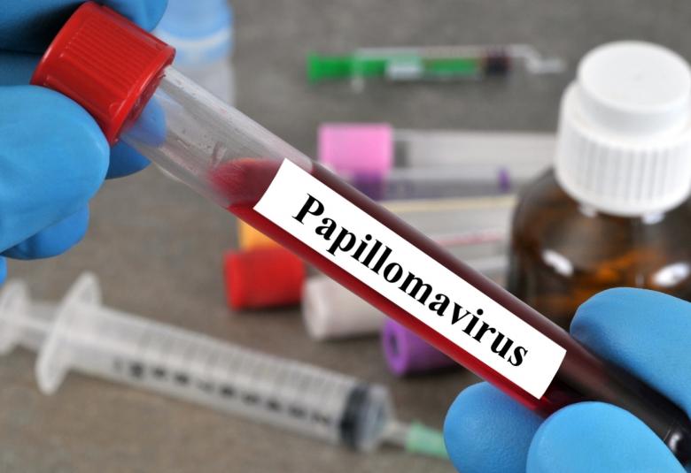 Massey researchers review geographic factors that affect HPV vaccination rates