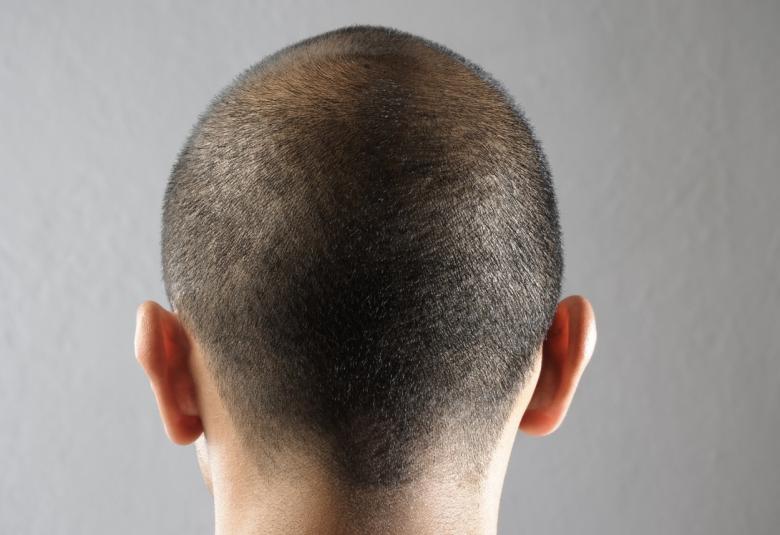 New combo therapy for head and neck cancer
