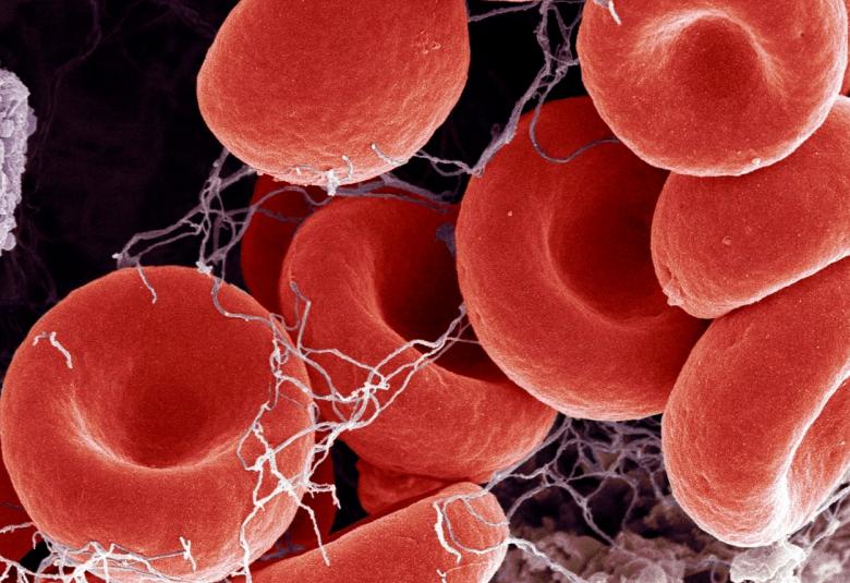 AstraZeneca vaccine unlikely to cause blood clots, says MHRA