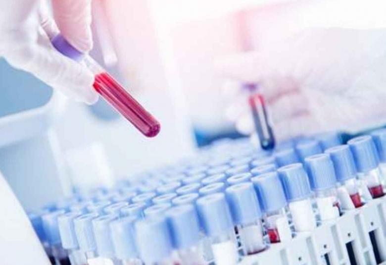 Anticoagulant has beneficial side-effects for COVID-19 patients