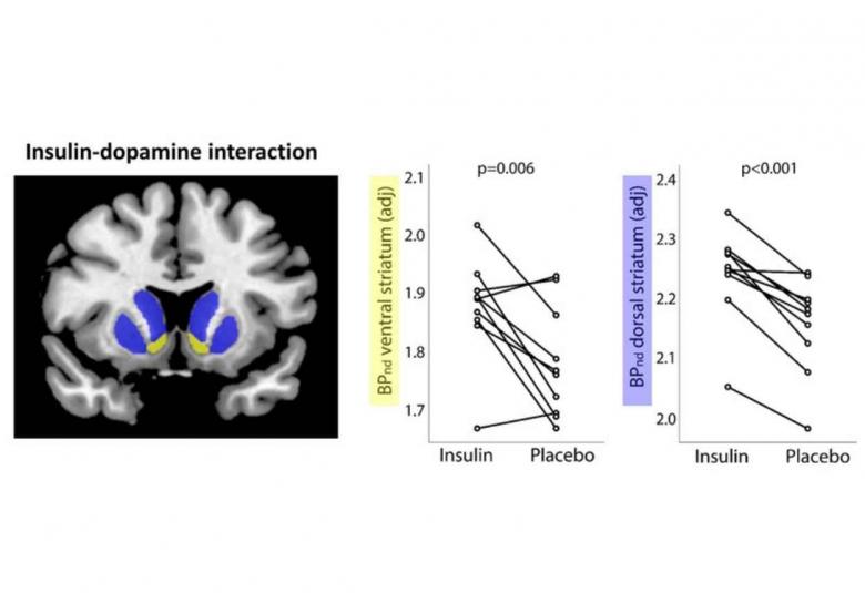 Insulin in the Brain Influences Dopamine Levels