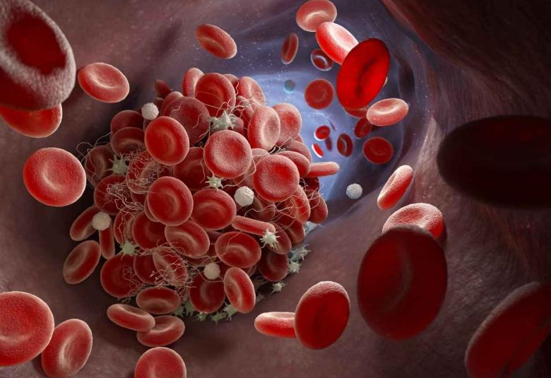 FDA approves Enjaymo, first treatment for use in patients with cold agglutinin disease