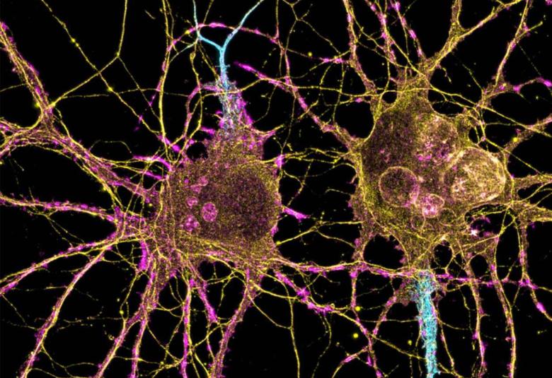 How Huntingtons disease affects different neurons