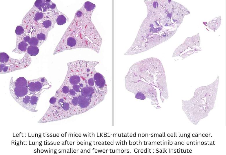 New combination of drugs works together to reduce lung tumors in mice