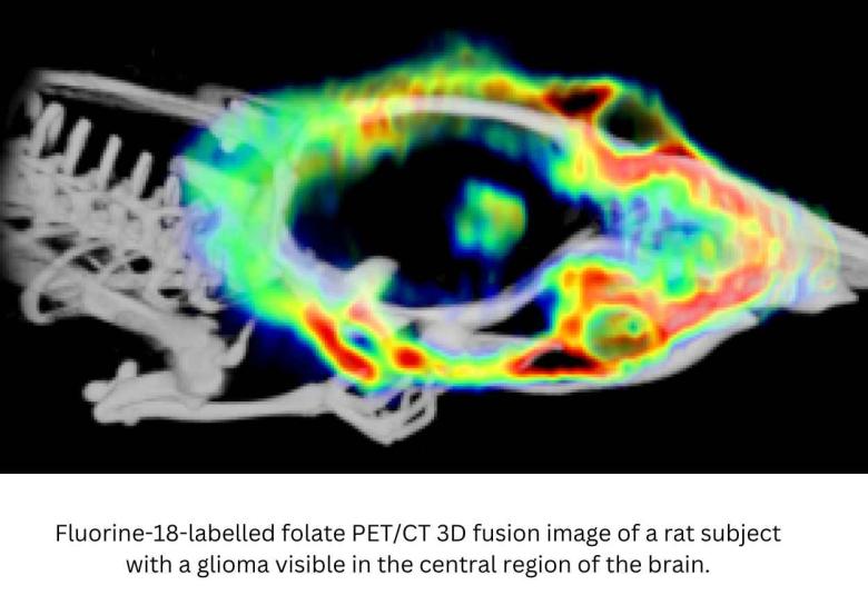 New Discovery Can Help Detect Brain Tumours