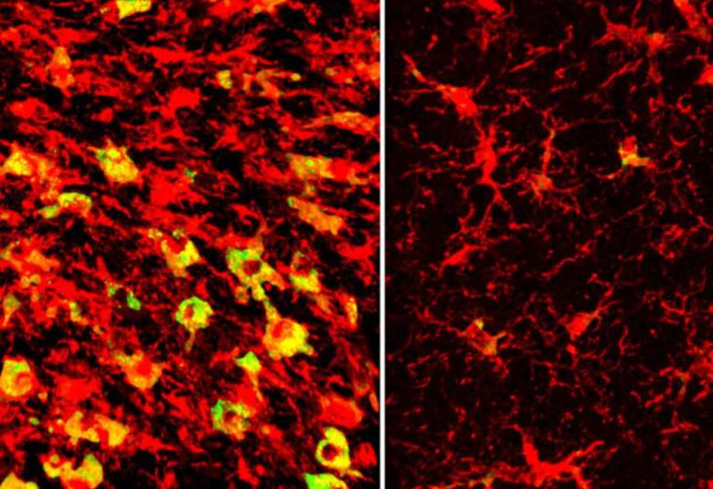 Lowering a form of brain cholesterol reduces Alzheimer’s-like damage in mice
