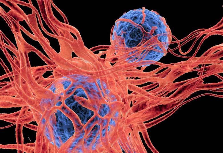 Researchers Identify Cell Signaling Pathway Controlling Melanoma Cell Metastasis to the Brain 