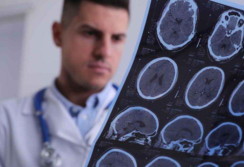 CAMH develops potential new drug treatment for multiple sclerosis