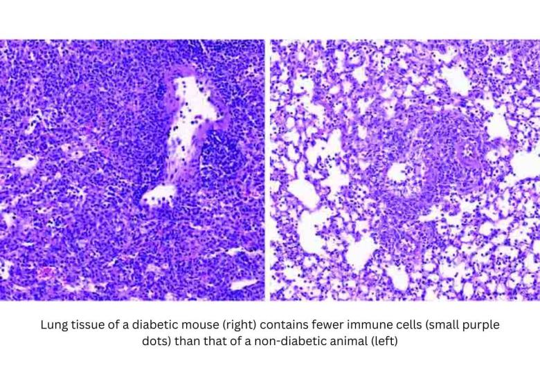 Why People with Diabetes Are More Prone to Respiratory Risk