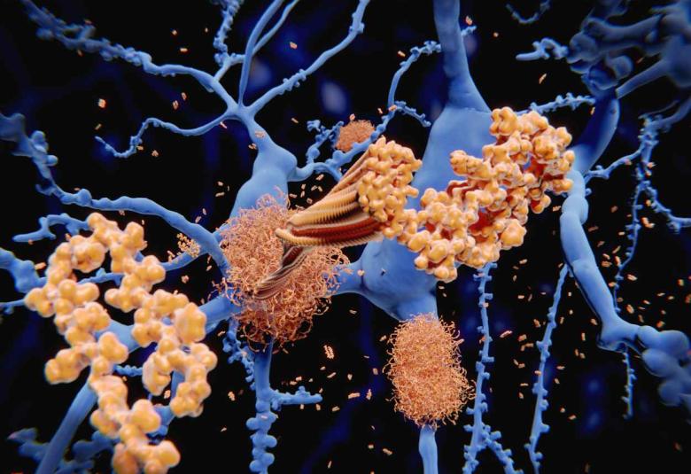 Lighting up Alzheimer’s-related proteins to allow for earlier disease detection