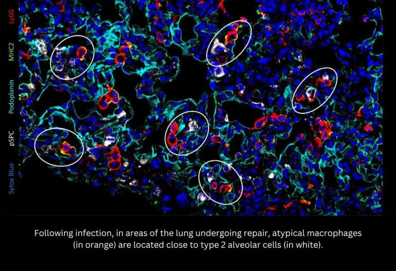 Discovery of a new population of macrophages promoting lung repair after viral infections