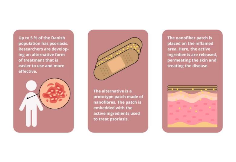 Researchers develop nanofiber patch for treatment of psoriasis