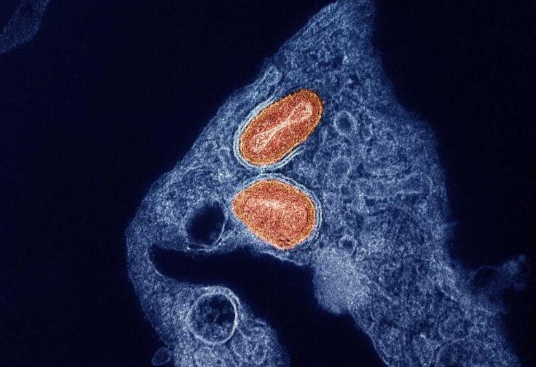 NIH Study Finds Tecovirimat Was Safe but Did Not Improve Mpox Resolution or Pain