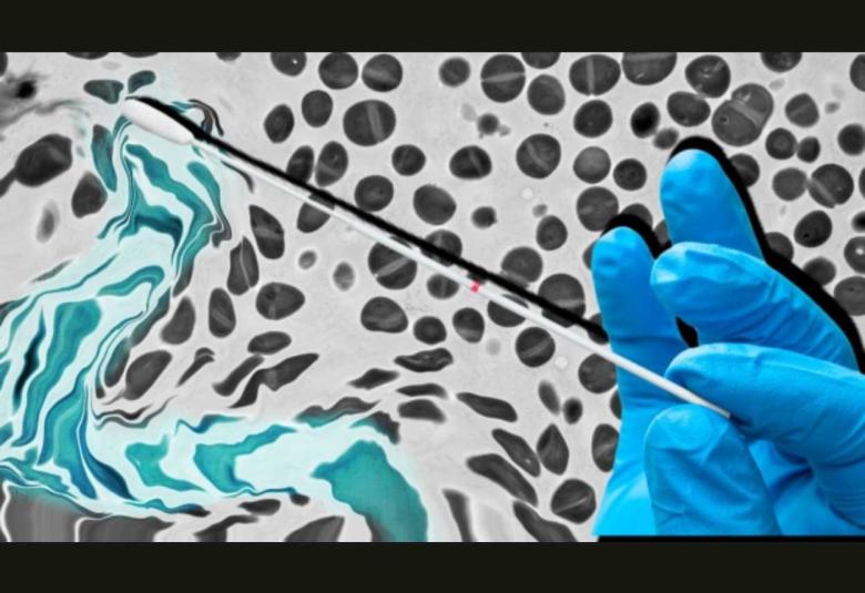 Stanford scientists transform ubiquitous skin bacterium into a topical vaccine