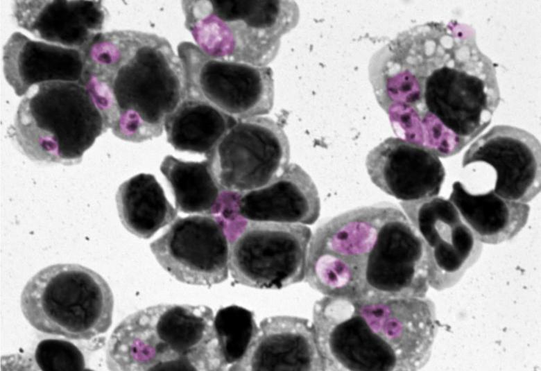 Researchers Discover Way to Predict Treatment Success for Parasitic Skin Disease