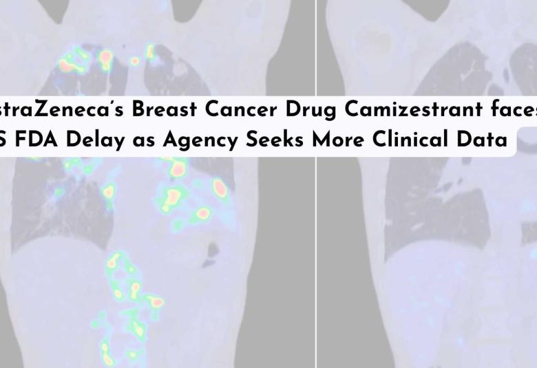 AstraZeneca’s Breast Cancer Drug Camizestrant faces US FDA Delay as Agency Seeks More Clinical Data