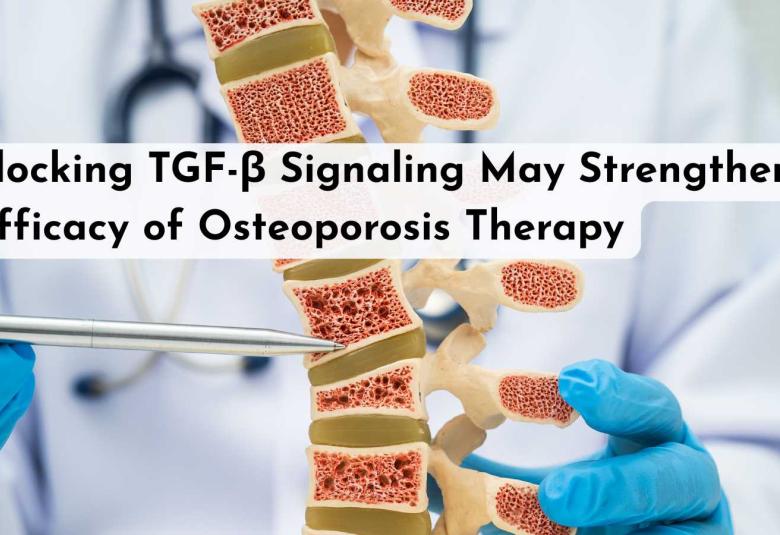 Blocking TGF-β Signaling May Strengthen Efficacy of Osteoporosis Therapy