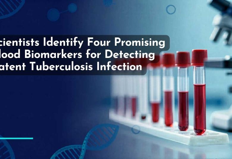 Scientists Identify Four Promising Blood Biomarkers for Detecting Latent Tuberculosis Infection