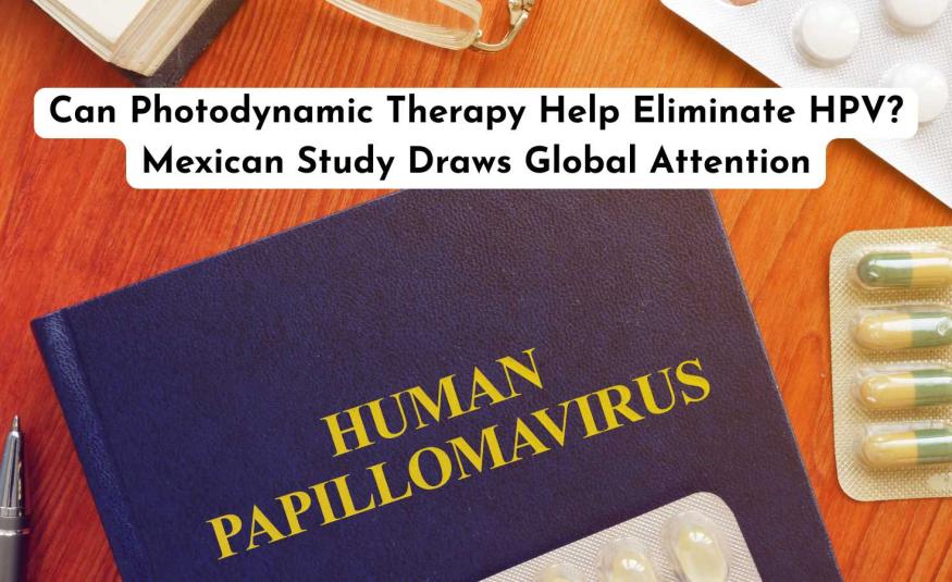 Can Photodynamic Therapy Help Eliminate HPV? Mexican Study Draws Global Attention