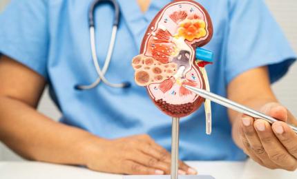The Forgotten Half of Diabetic Kidney Disease Finally Gets Its Own Trial and the Results Are Positive