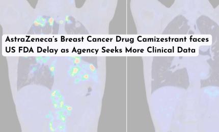 AstraZeneca’s Breast Cancer Drug Camizestrant faces US FDA Delay as Agency Seeks More Clinical Data