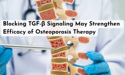 Blocking TGF-β Signaling May Strengthen Efficacy of Osteoporosis Therapy