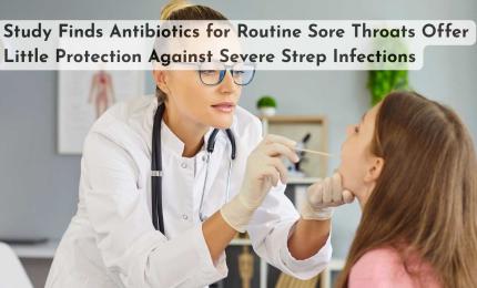 Study Finds Antibiotics for Routine Sore Throats Offer Little Protection Against Severe Strep Infections