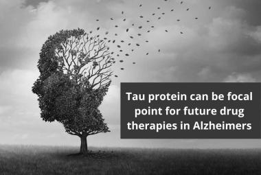 Tau protein can be focal point for future drug therapies in Alzheimers