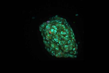 Personalized cancer medicine