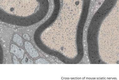 Repairing nerve cells after injury and in chronic disease