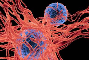 Researchers Identify Cell Signaling Pathway Controlling Melanoma Cell Metastasis to the Brain 