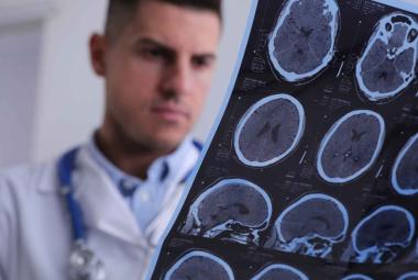 CAMH develops potential new drug treatment for multiple sclerosis