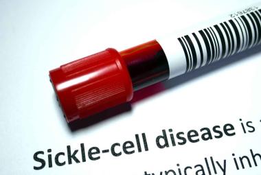 FDA approves first Gene Therapies to Treat Patients with Sickle Cell Disease