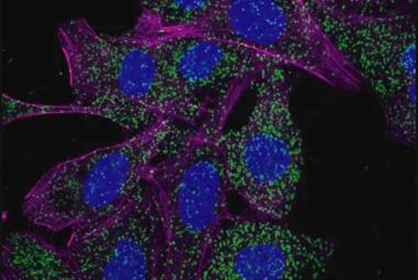 Leukemia cells activate cellular recycling program