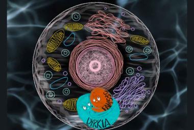 Protein-protein interaction discovery unveils Down syndrome's molecular mechanism potential