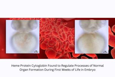 UMSOM Researchers Discover First Ever Link Between Hemoglobin-Like Protein and Normal Cardiac Development