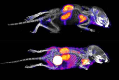 mRNA technology could be possible treatment for rare diseases