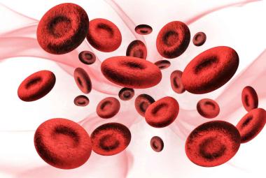 Precursor of Cholesterol Protects Cells From Ferroptosis