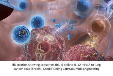 Study Finds New Inhalable Therapy is a Big Step Forward in Lung Cancer Research 