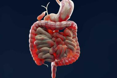 BMS medicine for Crohns disease fails in clinical trial