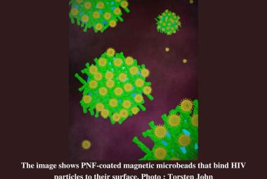 New method developed to isolate HIV particles