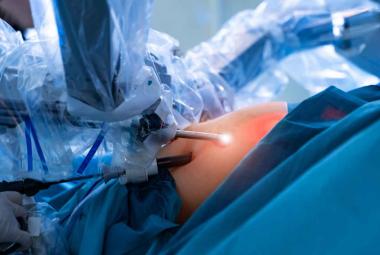 Bariatric surgery linked to heart health improvements in people with severe obesity