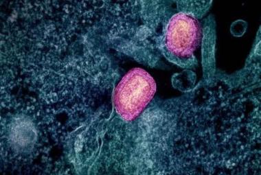 Lower Dose of Mpox Vaccine Is Safe and Generates Six-Week Antibody Response Equivalent to Standard Regimen