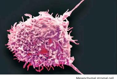 Mayo Clinic scientists pioneer immunotherapy technique for autoimmune diseases