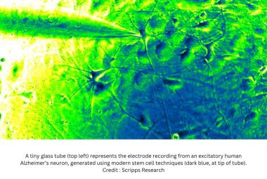 Scripps Research scientists uncover new molecular drivers of Alzheimer’s