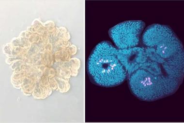New study demonstrates the efficacy of a promising celiac disease drug at the molecular level