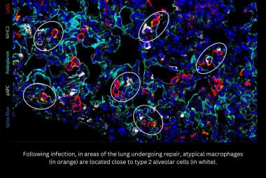 Discovery of a new population of macrophages promoting lung repair after viral infections