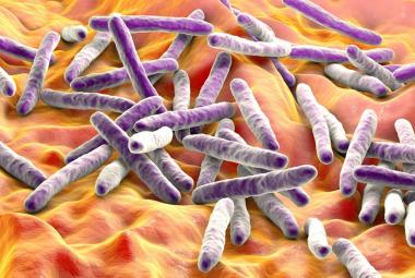 New findings on TB could change how we treat inflammatory disorders