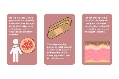 Researchers develop nanofiber patch for treatment of psoriasis